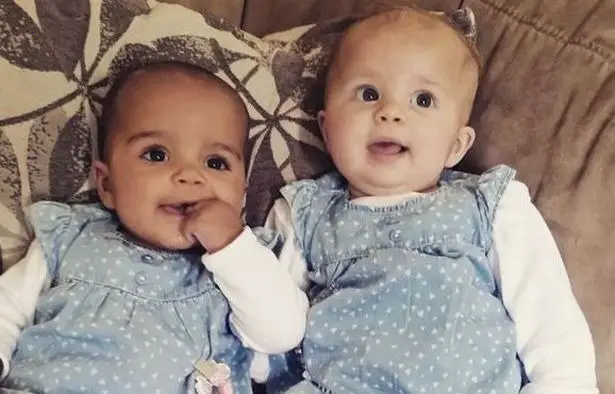 Meet The ‘One-In-A-Millon’ Twin Girls Who Were Born With Different Coloured Skin