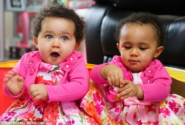 Meet The ‘One-In-A-Millon’ Twin Girls Who Were Born With Different Coloured Skin