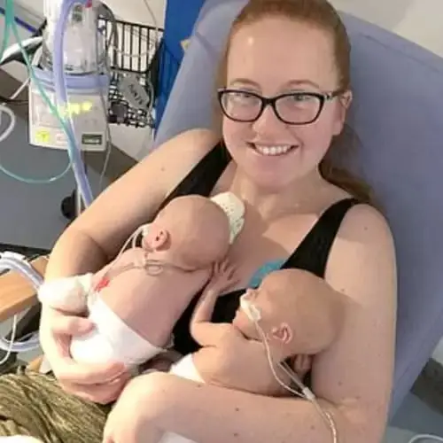 Moм Shocked As Twins Are Two Days Apart ‘It’s So Weird’