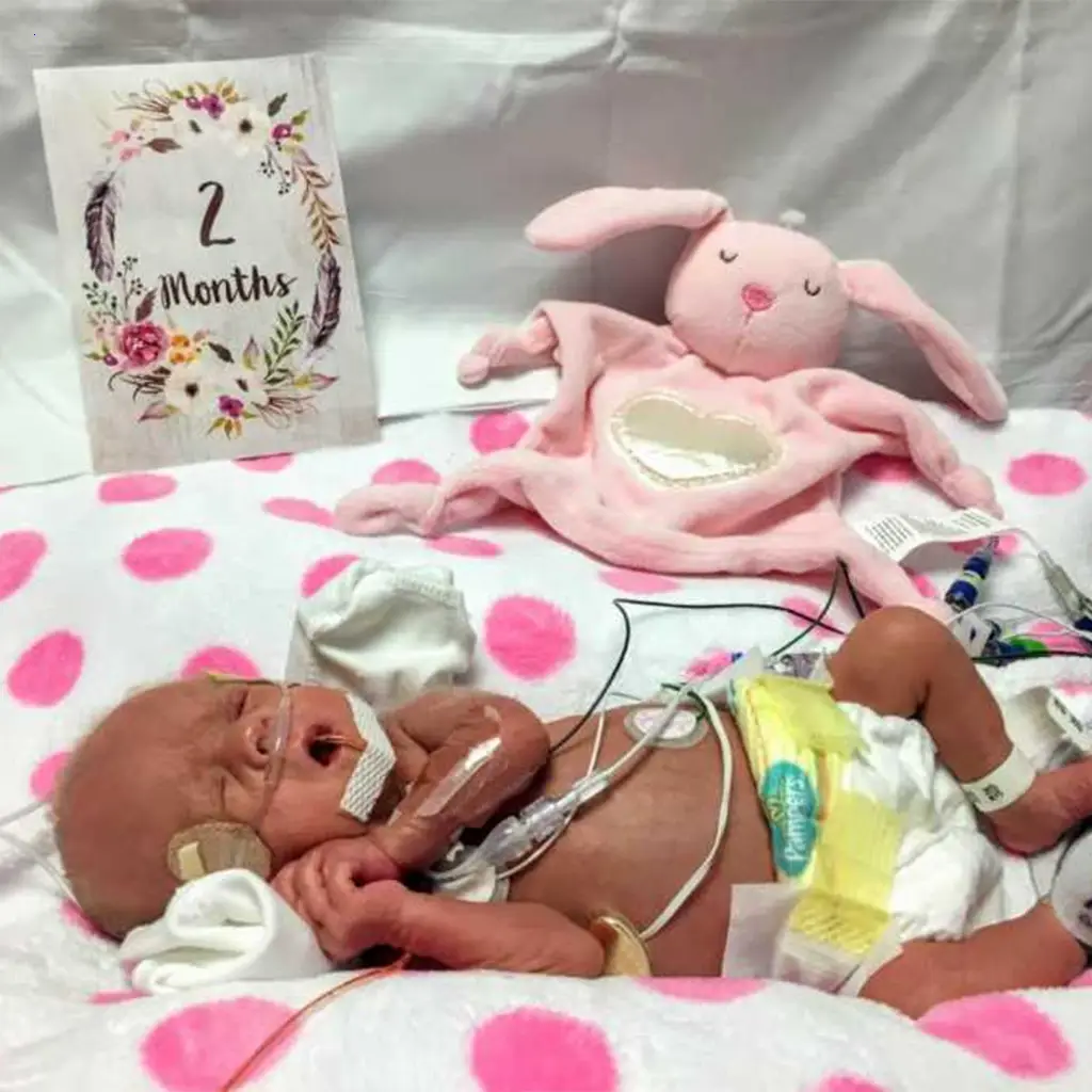 Defying the Odds: The Inspirational Saga of Twins Born at 20 Weeks, Conquering Every Challenge!