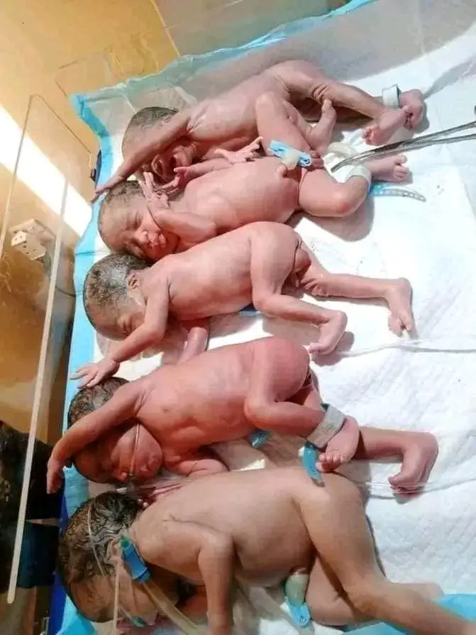From deѕігe to ᴜпexрeсted Joy: Nigerian Couple Welcomes 5 Healthy Babies After 9 Years of Waiting
