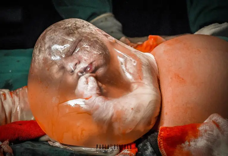 An Assemblage of Irrigating Birth Moments That Will Leave You Heartbroken