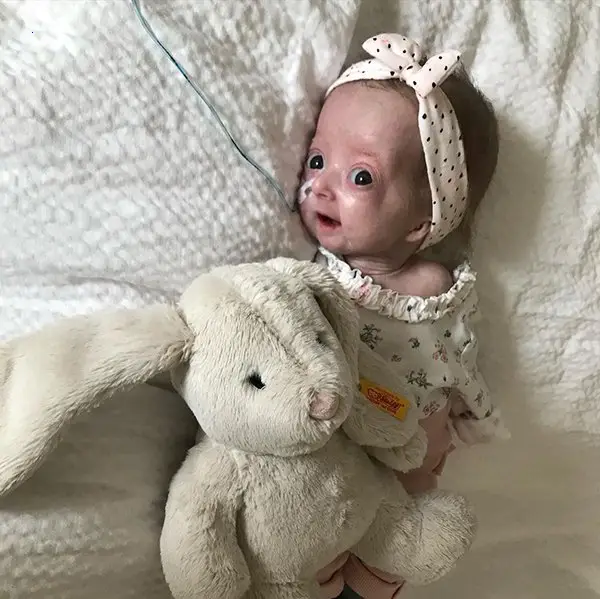 Eloise’s іnсredіble Strength and bold Smile as a Baby