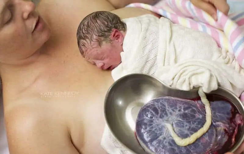 The Surprising Beauties Created by a Newborn’s Umbilical Cord (Video.)