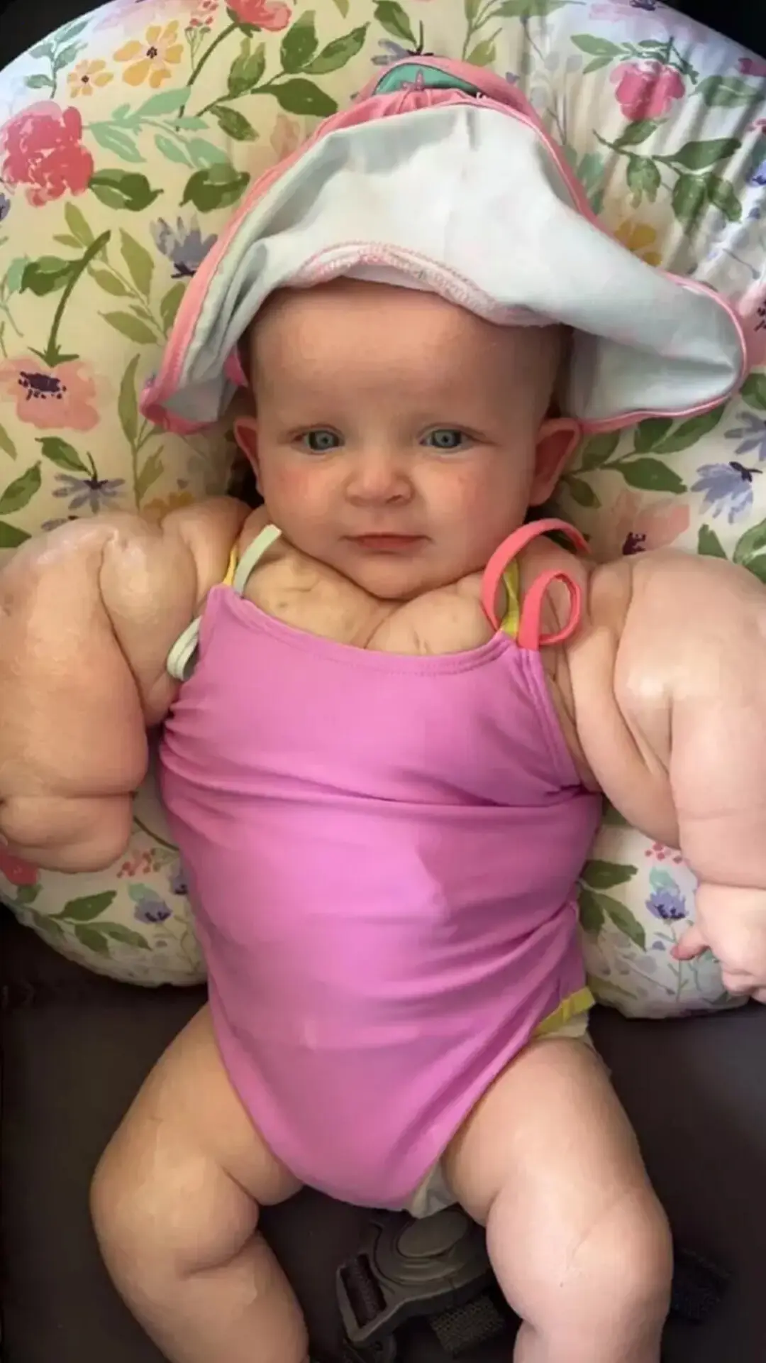 “A Heartbreaking Story of a Young Girl with the Body of a Bodybuilder” (Video.)