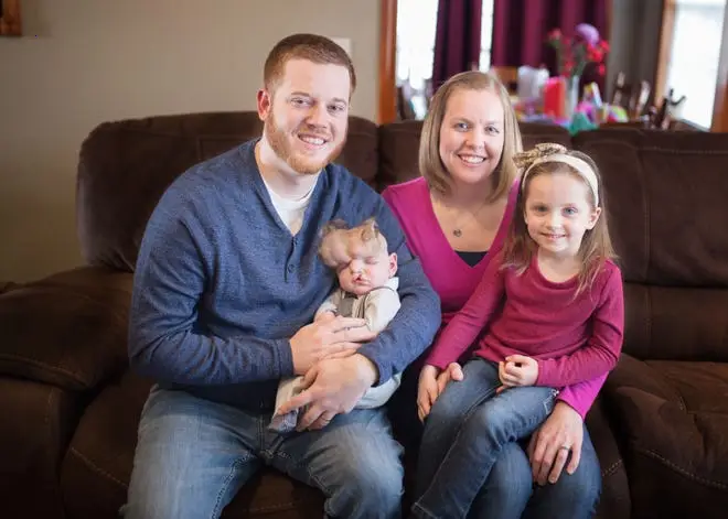 Heartfelt Resilience: Springfield Family’s Touching Saga with Their Baby Born Without a Skull