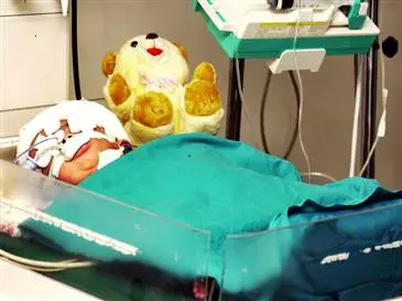 A Two-Headed Newborn’s Remarkable Journey Surprises and Inspires All
