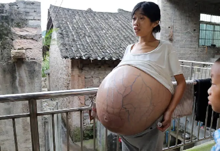 10 years pregnant woman still has not given birth, people say that she is pregnant with the child of the devil