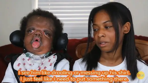 Beare-Stevenson Syndrome boy’s incredible journey against all odds, despite being told he would not survive more than a few seconds after birth (Video.)
