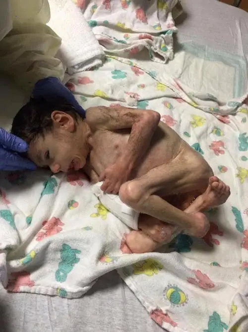 The astonishing act of a child woman adopting a 7-year-old boy weighing 3.6 kg is quite amazing (Video.)