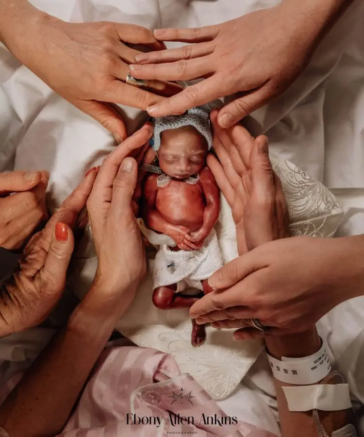 An Assemblage of Irrigating Birth Moments That Will Leave You Heartbroken