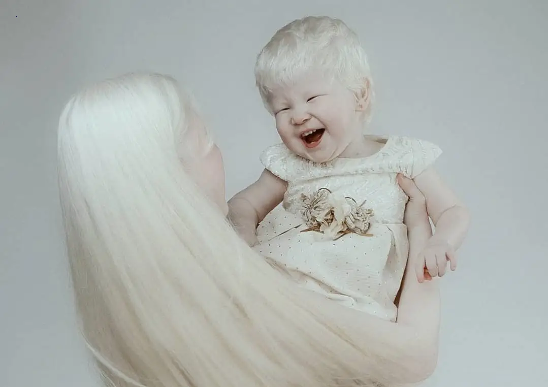 Captivating Charisma: The Enchanting Beauty of Two Albino Sisters Leaves a Lasting Impression