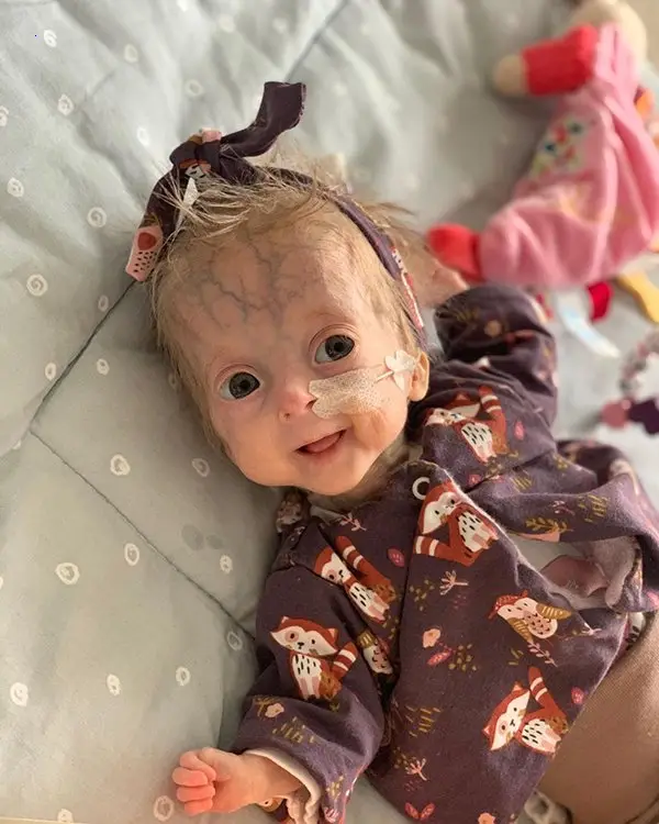 Eloise’s іnсredіble Strength and bold Smile as a Baby