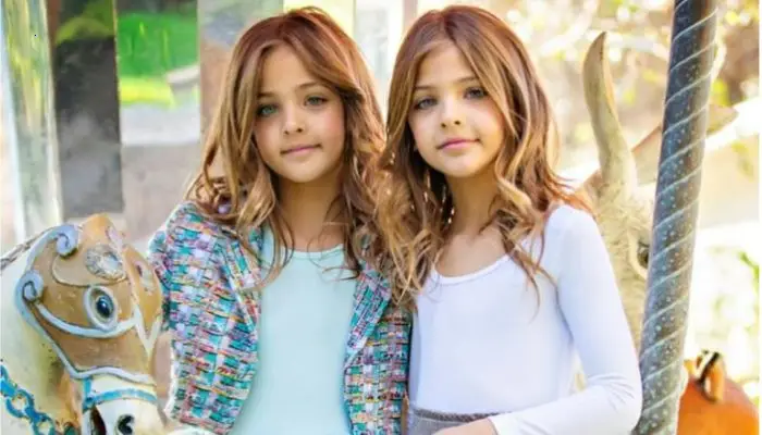 At the age of 6, they were recognized as the most beautiful twins in the world: what do they look like after 4 years?