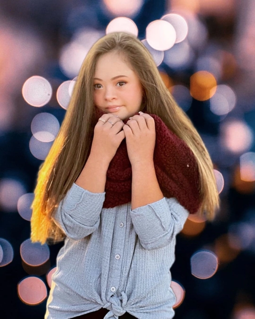 The mom was offered to dump her Down syndrome kid, but she refused – and the youngster went on to become a model.