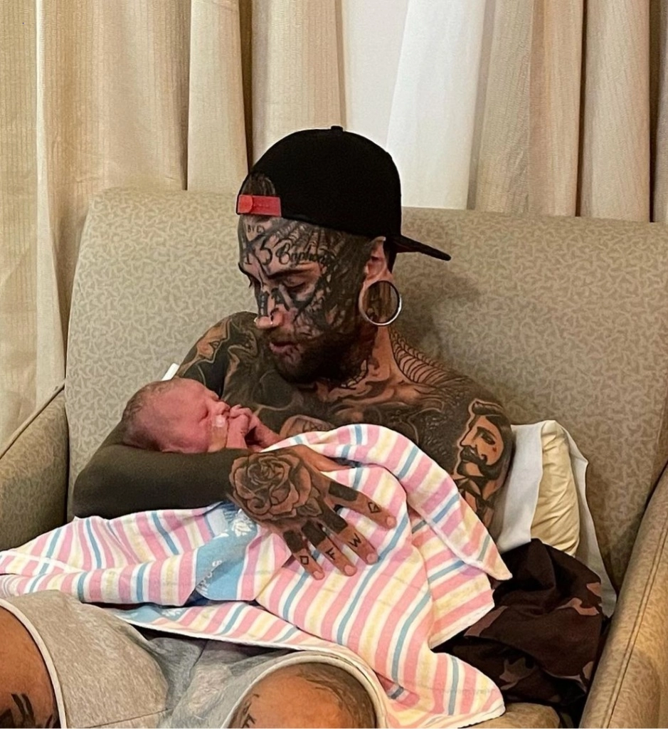 A 24-year-old man with tattoos all over his body removes them for the sake of his child.