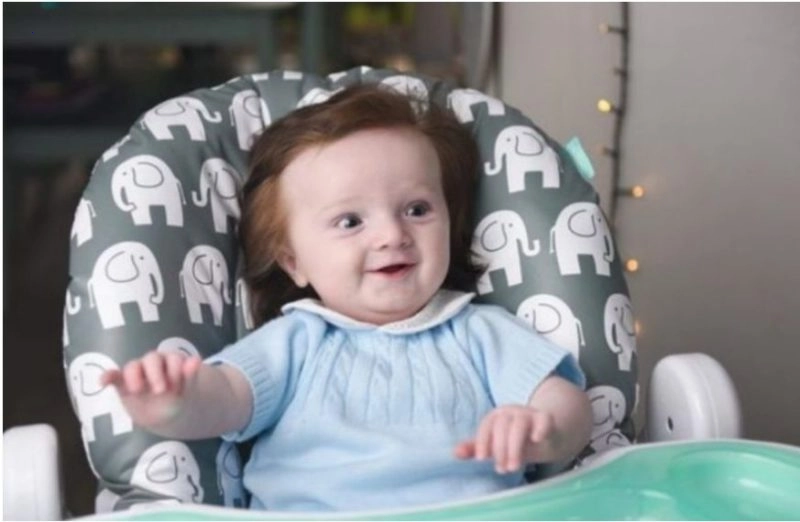 “Thick Hair on a Little Child’s Head”: A five-month-old baby is born with thick hair.