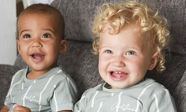 The British and Jamaican unusual twins. They are a year and a half old
