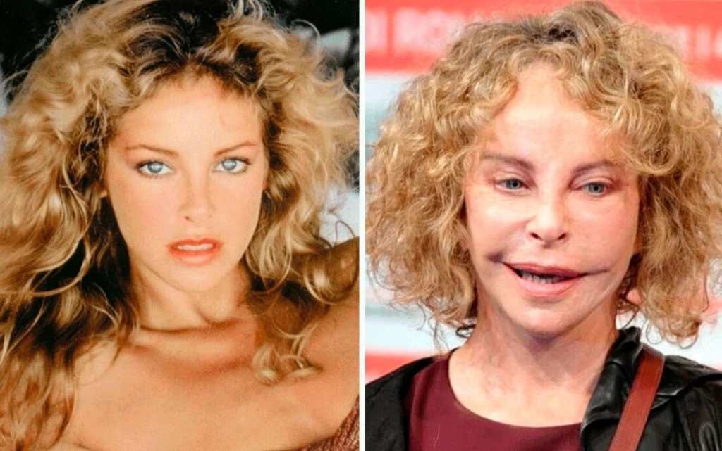 They simply spoilt themselves: photos of celebrities whose careers waned following cosmetic surgery