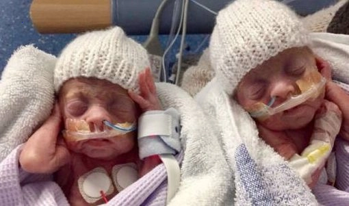 Twins born at 24 weeks survived: Now the boys are three years old – just look at them