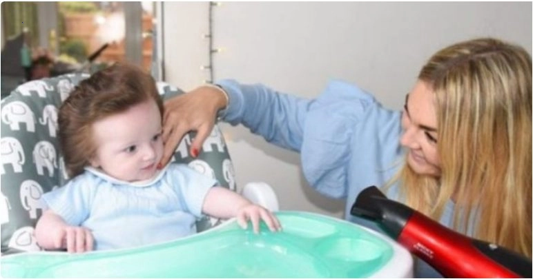“Thick Hair on a Little Child’s Head”: A five-month-old baby is born with thick hair.