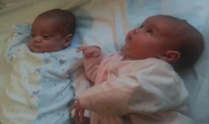 The mother gave birth to a girl and her twin sister after 87 days: What do girls look like these days?