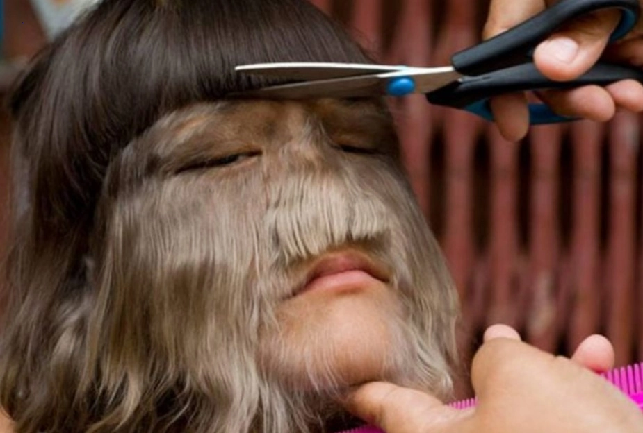 The girl with the most hair in the world chose to shave her face. Here’s what she looks like now.