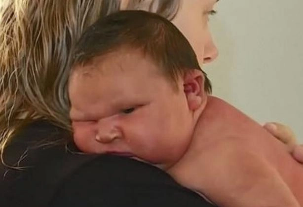 In Australia, a girl weighing 5.88 kg was born at 38 weeks!