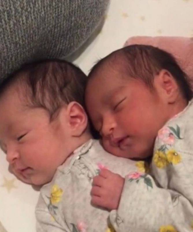 Everyone is crazy about how cute and small these twins are when they hug.