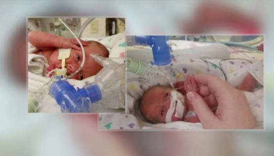 Family surprised everyone with three sets of twins born on the same day